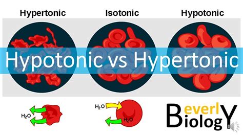 Hypotonic vs hypertonic. Things To Know About Hypotonic vs hypertonic. 