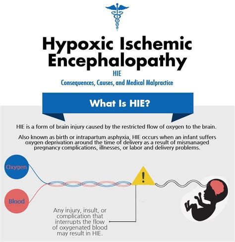 Hypoxic Ischemic Encephalopathy (HIE) Epilepsy Foundation