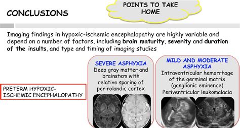 Hypoxic Ischemic Encephalopathy - an overview