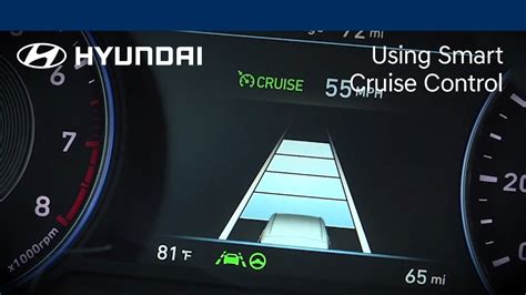 Hyundai Kia SCC smart cruise control operation 2015-2024