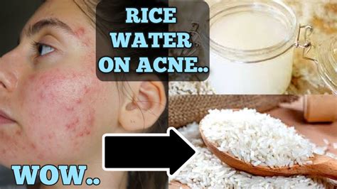 I Tested Rice Water for 1 Week Straight - YouTube