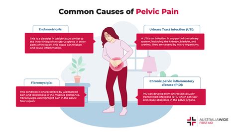 I felt something pop in my pelvic area.  Learn more about its symptoms...