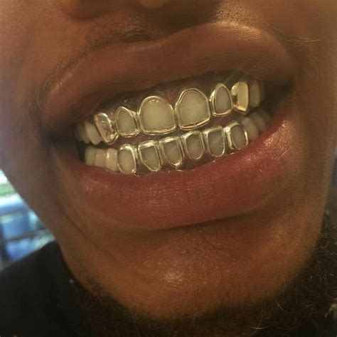 I make grillz.  The most popular styles include open-face (window) frames,...