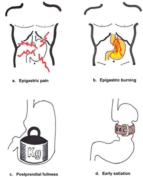 IBS and Gastroparesis: Are They Related?