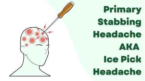 ICE Pick Headaches: Primary Stabbing Headaches Chicago