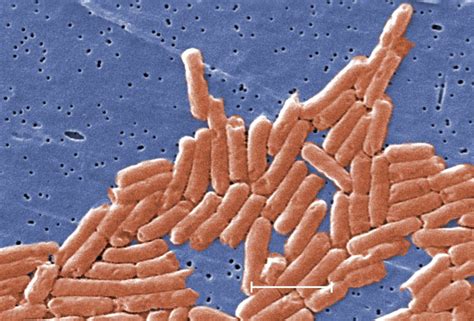 IDPH investigating Salmonella outbreak after 26 cases in Chicago area
