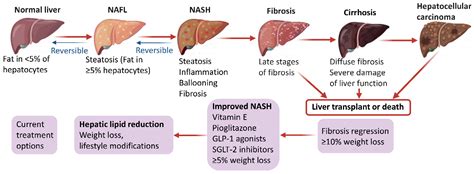 IJMS Free FullText Advances in the Diagnosis and Treatment of Non