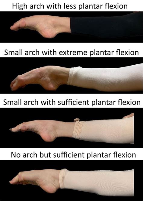 Improving the feet for ballet. Before we talk about how to ... - muktibox.com