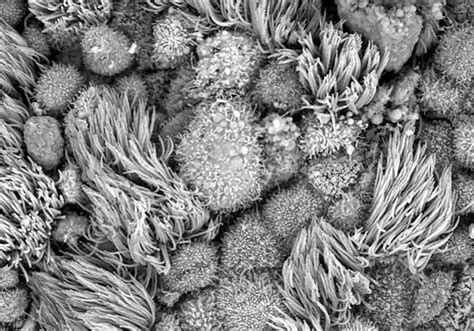 In pictures: details revealed with advanced SEM - wintechmobiles.com