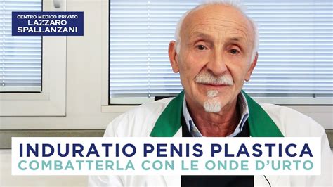 INDURATIO PENIS PLASTICA Combatterla con le onde d