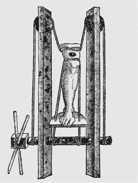 Innovations in Treatment of Femoral Fractures Throughout History - wintechmobiles.com