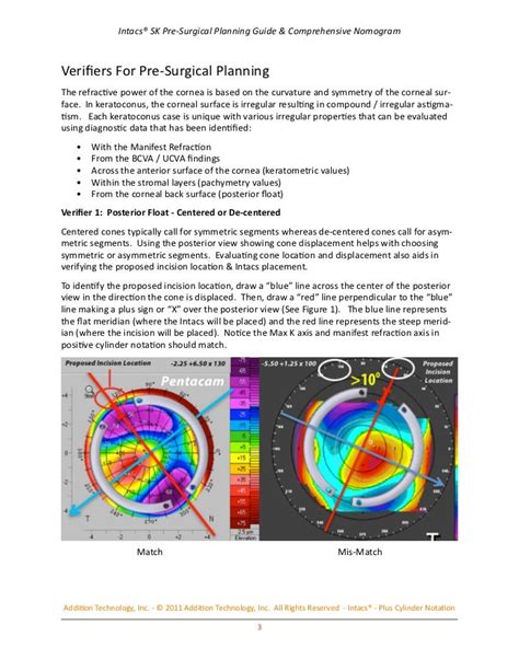 INTACS SK nomogram - [PDF Document]