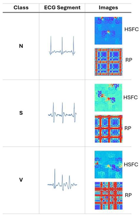 Intro_to_ECG_Heartbeat_Classification.ipynb - Colab - coolestguyplanet.net