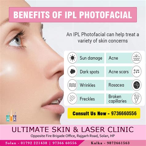 IPL Photofacial Benefits, Pain, Recovery, …