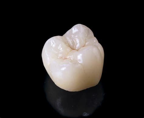 IPS Empress Dental Crowns EA Dental