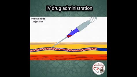 IV administration explanation