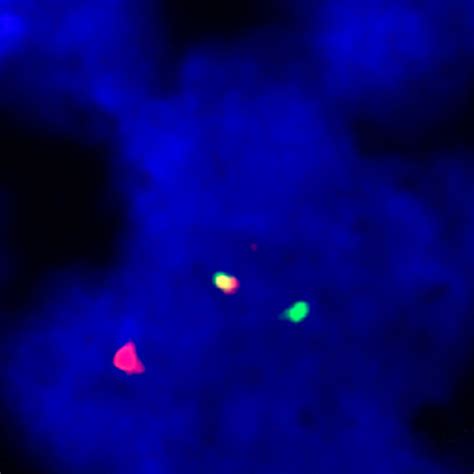 IVD IRF4/DUSP22 Break - ISH Probes - Molecular Pathology