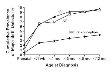 IVF Birth Defects - IVF1