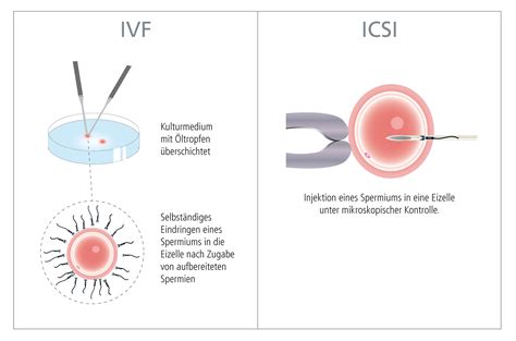 Ibadan, Nigeria ICSI IVF Fertility Clinics - ovu.com