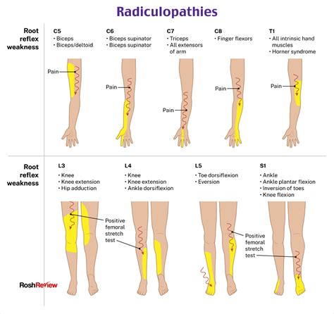 Icd 10 Code For Dvt Lower Leg