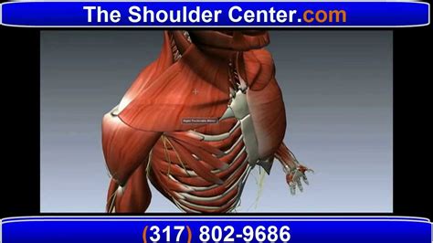 Icd 10 Code For Tendinitis Of Right Rotator Cuff