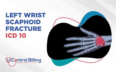 Icd 10 code for fracture of wrist. Search Page 1/1: s62112. 8 result found: ICD-10-CM Diagnosis Code S62.112. Displaced fracture of triquetrum [cuneiform] bone, left wrist. ICD-10-CM Diagnosis Code S62.112A [convert to ICD-9-CM] Displaced fracture of triquetrum [cuneiform] bone, left wrist, initial encounter for closed fracture. 
