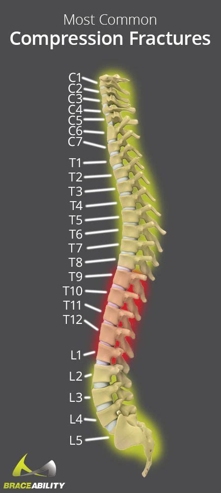 Icd 10 code for t11 compression fracture. This page provides explanations for the ICD diagnosis code “S22.1 Multiple fractures of thoracic spine” and its subcategories. 