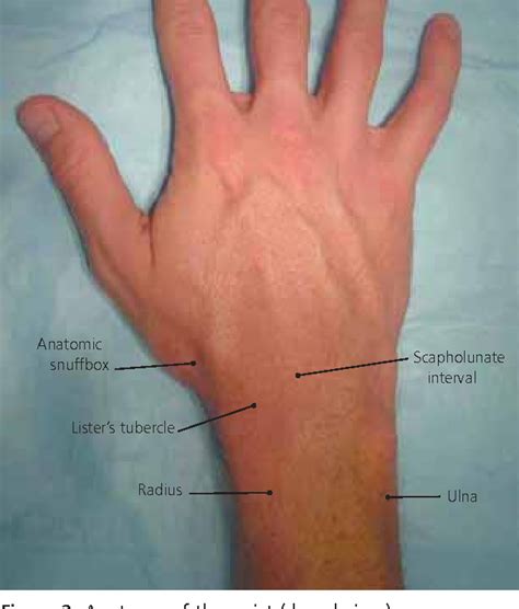 Strain, laceration of muscle, tendon, or fascia a. Describe exact tendon and label as flexor or extensor or abductor muscles. 5. Hand/Wrist i. Subluxation .... 