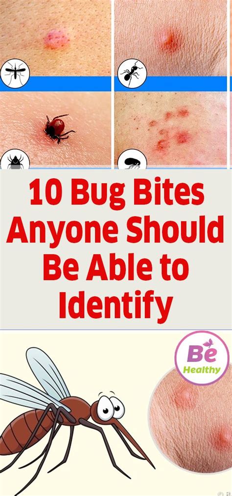 Identify bug bite by picture. The U.S. has 11 species of kissing bugs. Texas A&M University is one of the universities in the U.S. that takes bugs for identification. They have a Kissing Bugs & Chagas Disease in the United ... 