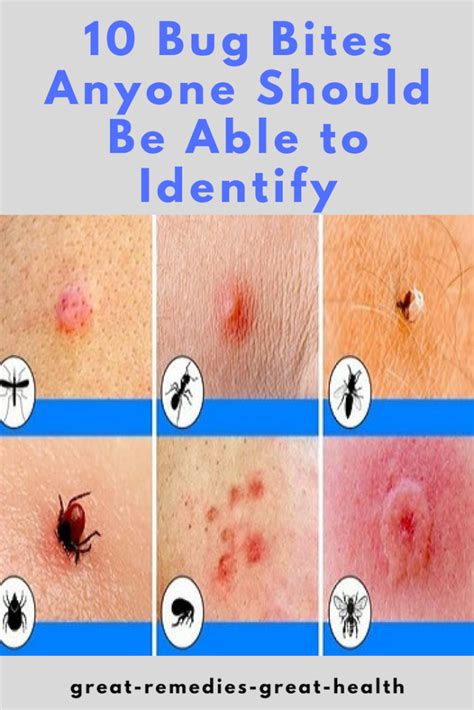 How to Avoid Gnat Bites. Here are a few different ways to keep gnats 