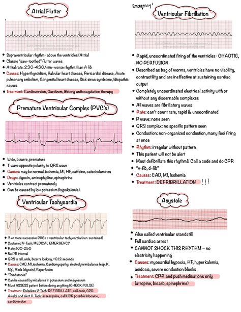 1 / 3 AACN: Essentials of ECG and Dysrhythmia Monitoring - Module 2: Identifying Dysrhythmias: Lesson 4: Ventricular Rhythms. 