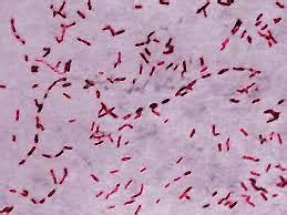 Ignavibacteria - Wikidata