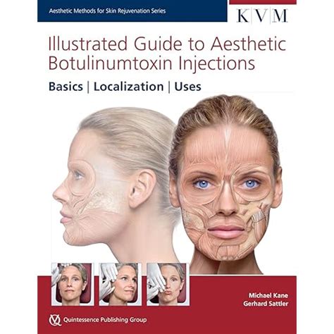 Illustrated guide to aesthetic botulinum toxin injections dosage localization uses. - Honda trx 200 manual or automatic.