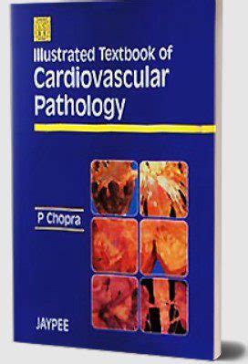 Illustrated textbook of cardiovascular pathology by p chopra. - Laser miracolo laser lasik la guida completa al meglio.