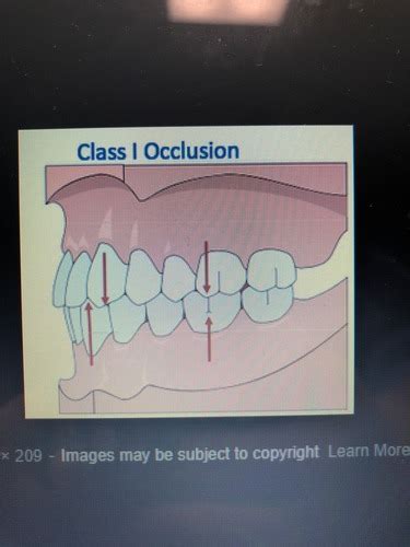 Image Occlusion Quizlet