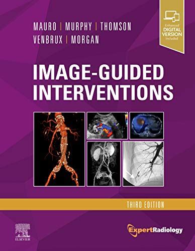 Image guided interventions expert radiology series. - 2011 suzuki gsxr 750 owners manual.