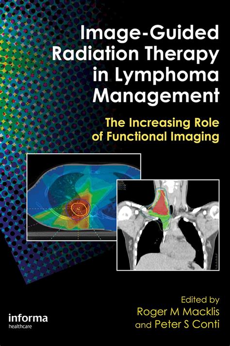 Image guided radiation therapy in lymphoma management by roger m macklis. - John deere 214 lawn tractor manual.