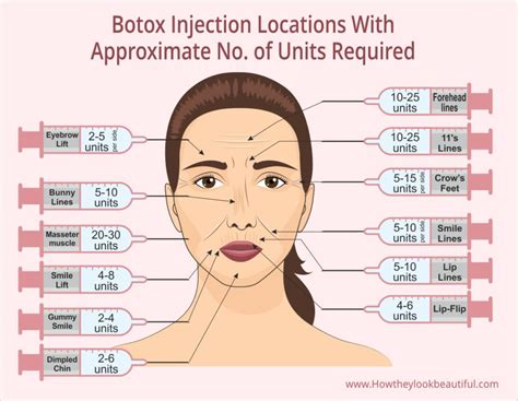 Image result for Botox Injection Map Botox injection sites, Botox