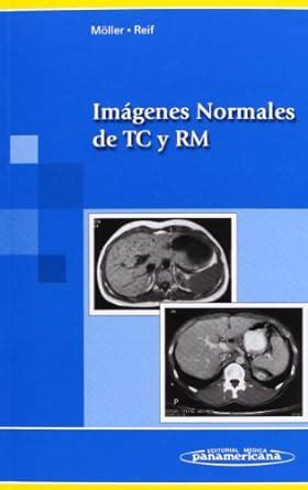 Imagenes normales de tc y rm. - Dizionario chimico condensato di hawley 13a edizione.