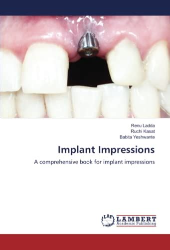 Implant Books - Goodreads