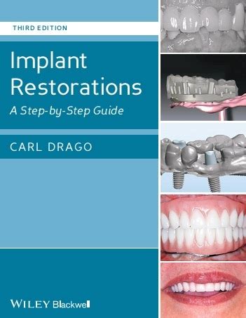 Implant restorations a step by step guide 2nd edition. - Das vergess' ich nie mehr, solange ich lebe--.