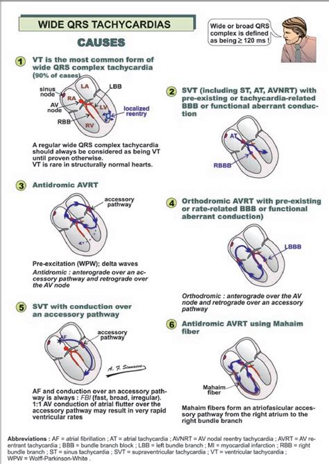 Implantable cardioverter defibrillators step by step an illustrated guide. - Mice and men guided questions answer key.