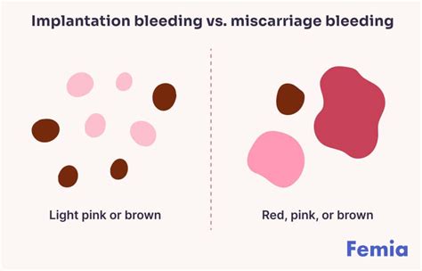 Implantation bleeding vs miscarriage.  Understanding Implantation vs Miscarriage Ble...
