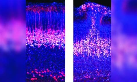 Impresionante hallazgo en el cerebro de los ratones podría aportar a la investigación sobre el autismo