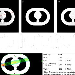 Improving cone-beam CT quality using a cycle-residual ... - PubMed