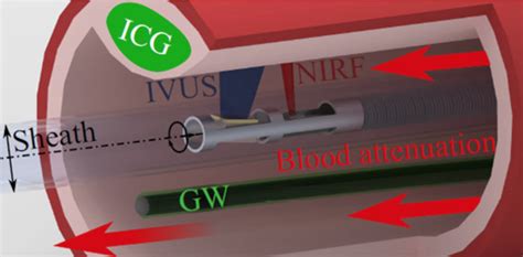 Improving the accuracy of near-infrared fluorescence in cardiovascular …