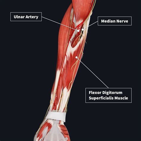 In your forearms, there is one very small muscle that contracts …