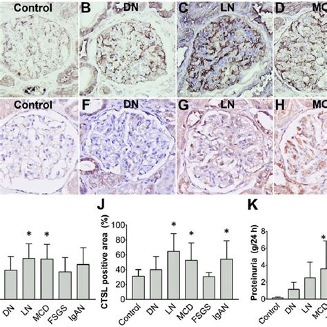 Increased dynamin expression precedes proteinuria in glomerular disease