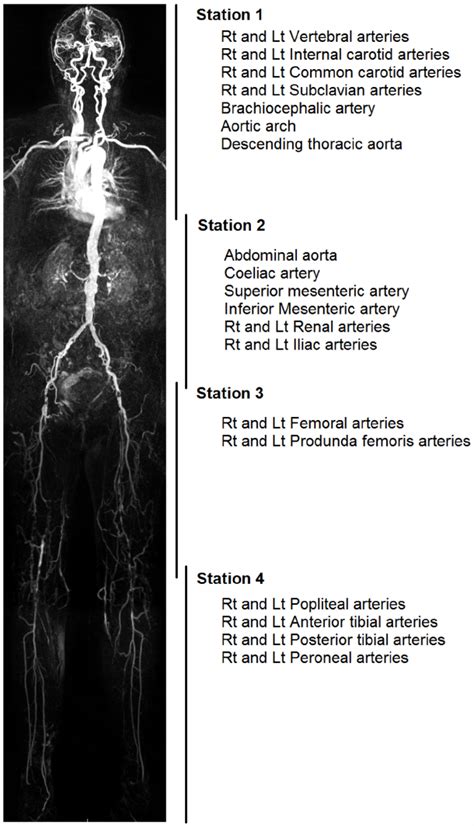 Indications for MRA(magnetic resonance angiography) whole body