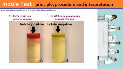 Indole Test principle, procedure and interpretation Lab Tests Guide